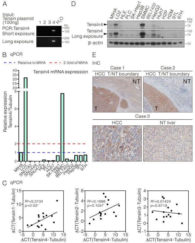 Tensin4 expression in HCC cells.