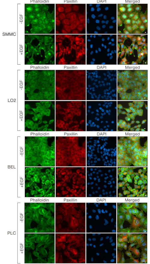 EGF induced morphological changes in cells with Tensin4 up-regulation.