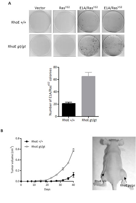 RhoE deficiency cooperates with E1A and Ras