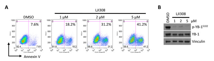 LJI308 kills TNBC correlative with YB-1 inhibition.