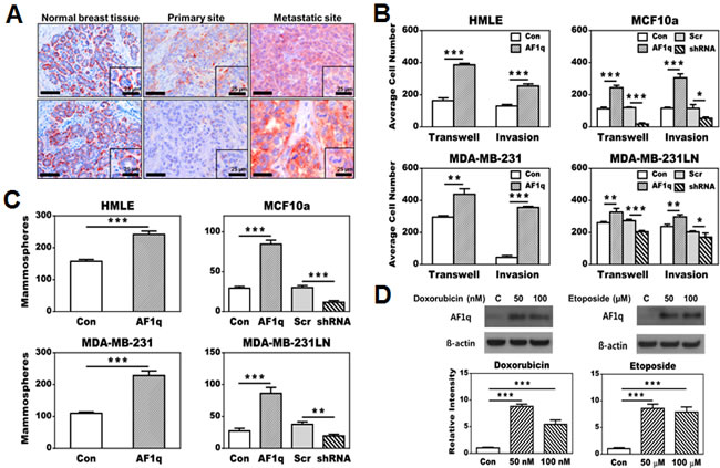 Effects of AF1q expression in breast normal epithelial (HMLE and MCF10a) and cancer cell lines (MDA-MB-231 and MDA-MB-231LN).