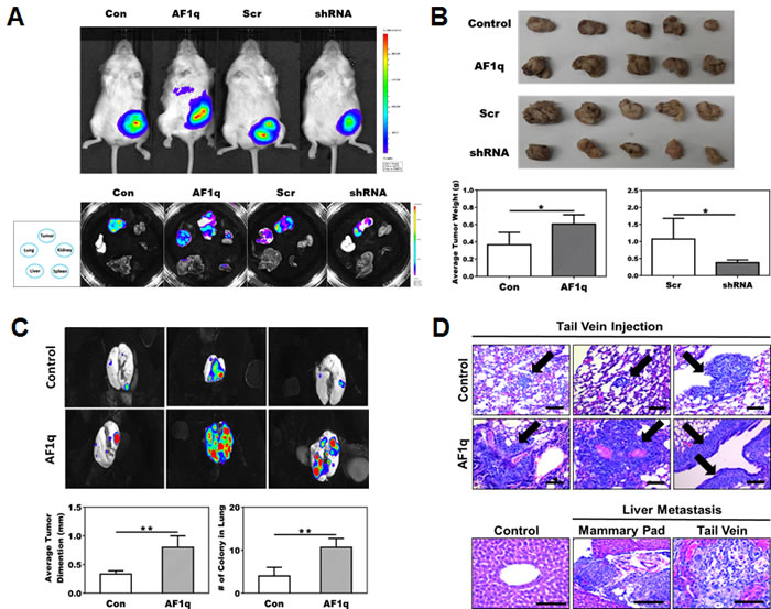 NOD/SCID xenograft mouse models confirm the association of AF1q with breast cancer metastasis.