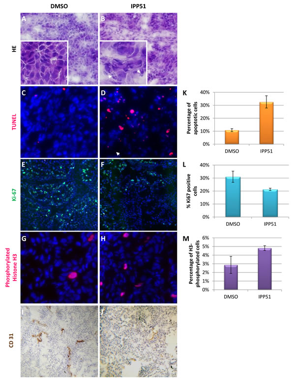 IPP51 induces cell proliferation inhibition, mitotic arrest, apoptosis and angiogenesis inhibition