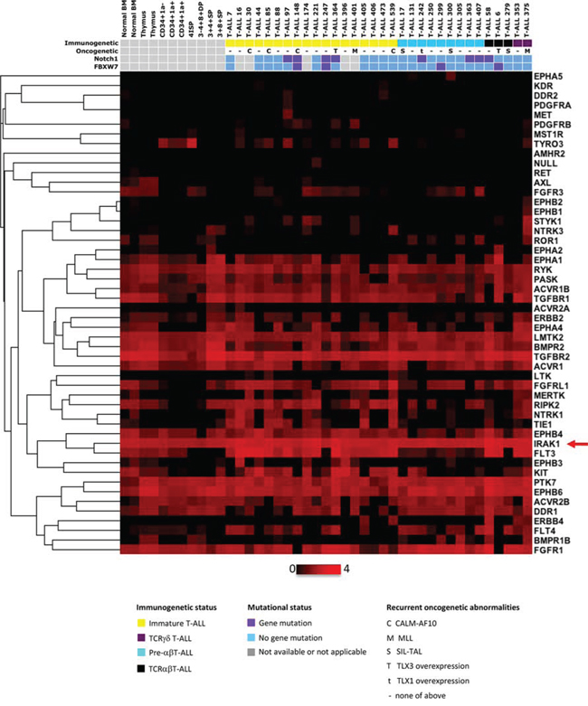 Kinases expression profiles of human T-ALL samples and thymic subpopulations.