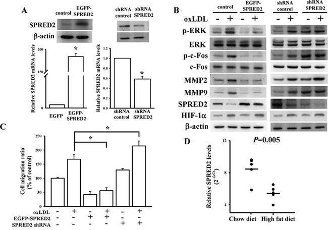 Identification of SPRED2 effects on oxLDL-induced HASMC migration.