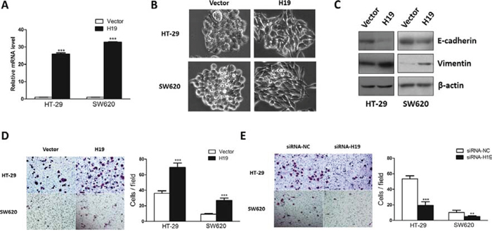 Ectopic expression of H19 promoted epithelial to mesenchymal transition.