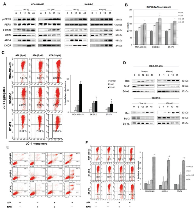 ATA triggers ER and oxidative stresses and induces loss of mitochondrial membrane potential.