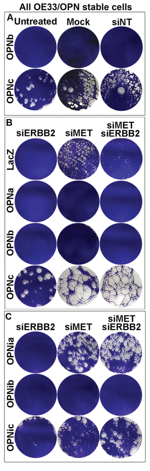 OPN isoform-expressing cells differ in cell detachment phenotypes that can be modulated by the MET oncogene.
