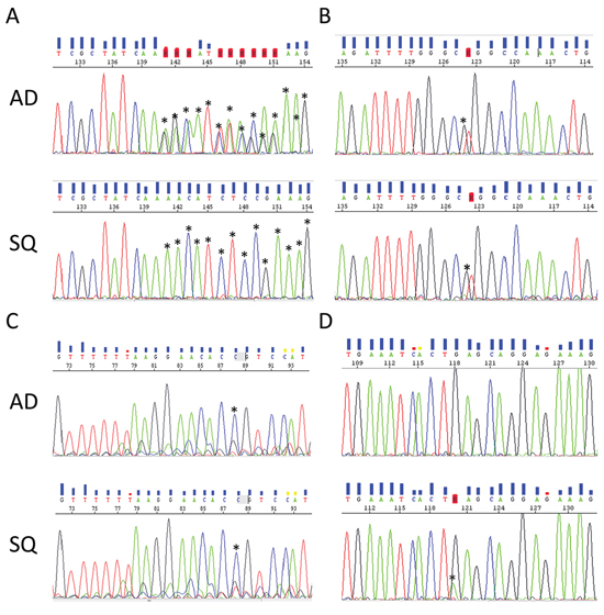 Representative electropherograms of EGFR and PIK3CA genes from corresponding AD (upper panel) and SQ (lower panel) components.