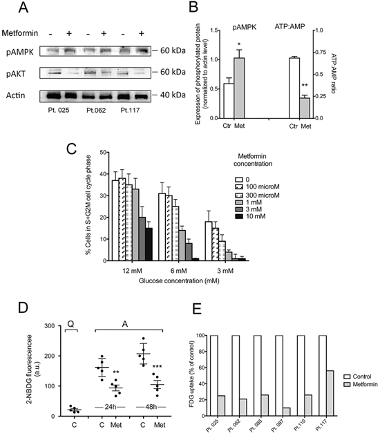 Metformin increases CLL cell AMPK phosphorylation and decreases intracellular phosphorylated glucose available for glycolysis.
