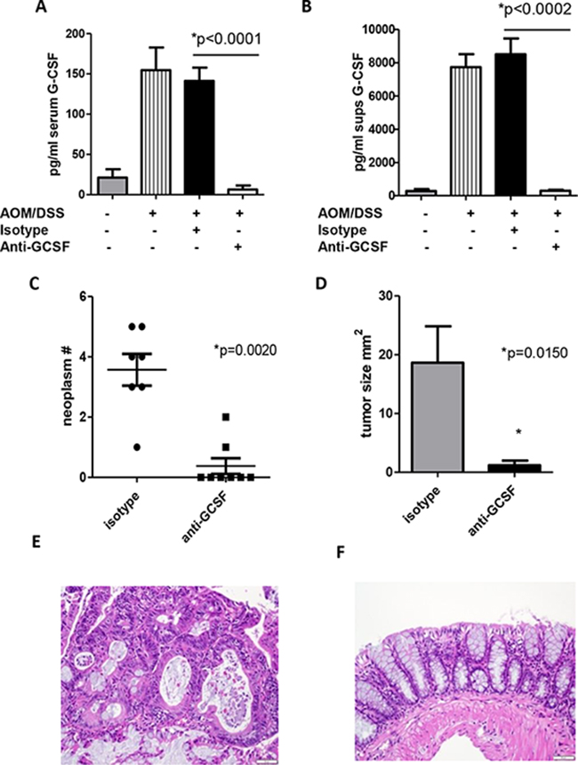 G-CSF plays an important role in neoplasm development in AOM/DSS treated mice.