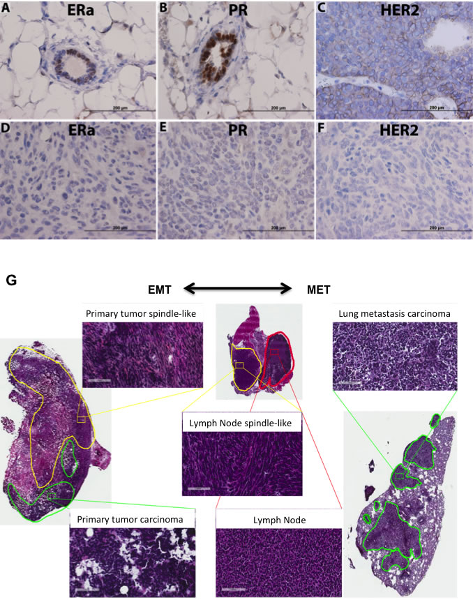 JygMC(A) mammary primary tumor molecular phenotype, histology and EMT-MET plasticity.