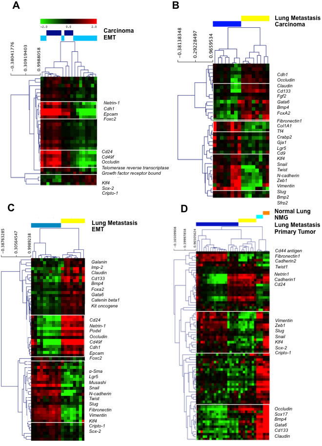 Gene expression profiles of laser capture microdissected tumor progression samples through unsupervised hierarchical clustering.