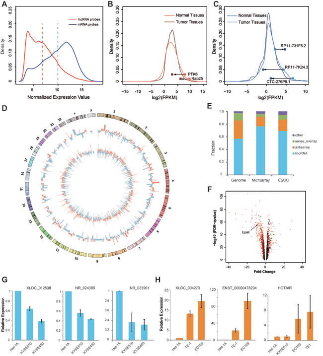 Transcriptome analysis of long noncoding RNAs in esophageal squamous cell carcinoma (ESCC).