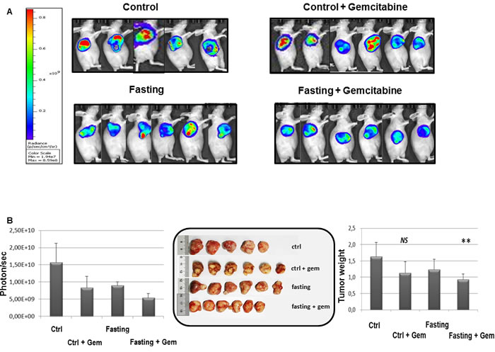 Effect of fasting on PC tumor.