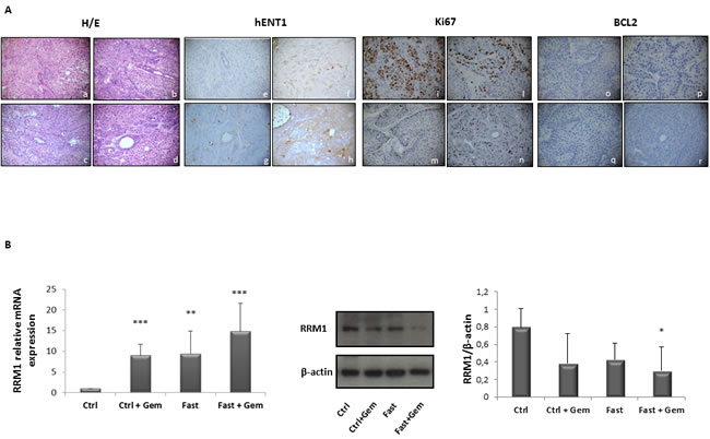 Immunoistochemical evalutation of hENT1, Ki67 and BCL-2 expression in PC biopsies of mice allocated in to the 4 different groups.