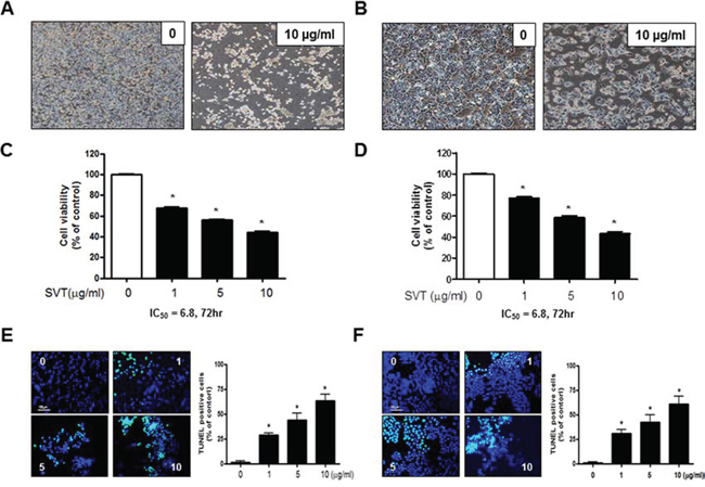 Effect of SVT on cell growth and apoptotic cell death in lung cancer cells.