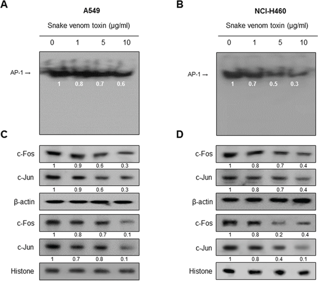 Effect of SVT on AP-1 activaion.