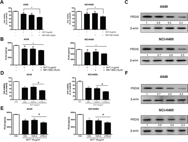 Effect of SVT with AP-1 inhibitor (SR11302) and siRNA of c-Fos on the expression of PRDX6.