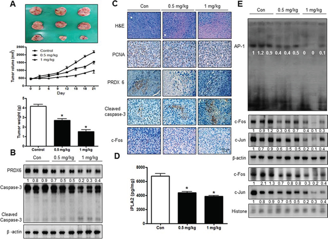 SVT inhibited tumor growth in vivo xenograft.