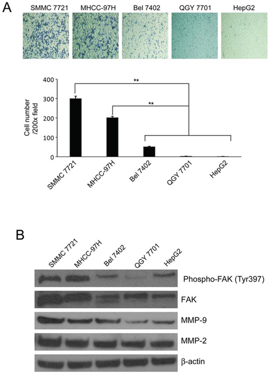 The invasiveness and the expression of FAK, phosphorylated FAK Tyr397 and MMP2/9 in HCC cells.