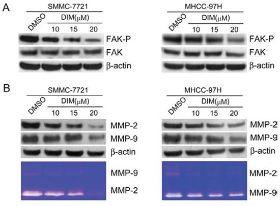 DIM inhibited FAK phosphorylation and decreased the expressions and activities of MMP-2 and MMP-9 in SMMC-7721 and MHCC-97H cells.