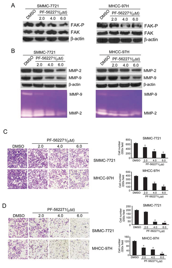 FAK inhibitor PF-562271 decreased the MMP2/9 levels and suppressed the invasion and metastasis of SMMC-7721 and MHCC-97H cells.
