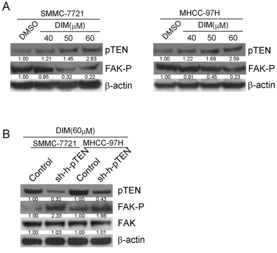 DIM inhibited the phosphorylation of FAK by up-regulating the expression of pTEN.