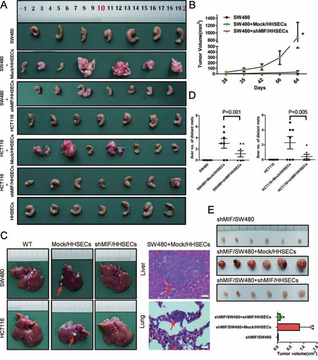 MIF increases the stimulatory effects of HHSECs on CRC cell umorigenesis and metastasis.