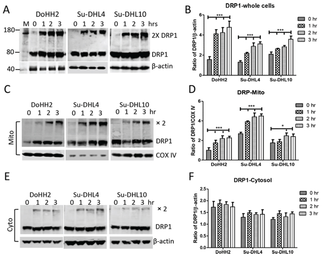 Irradiation induced DRP1 mitochondrial translocation and oligomerization.