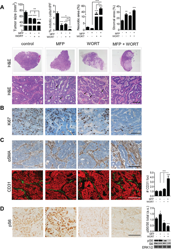 Combination of MFP and WORT improves C4-HI tumor regression.