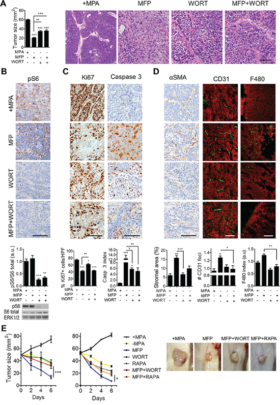 Inhibition of PI3K/Akt/mTOR pathway interferes with the stromal reaction induced by endocrine therapy in C4-HD tumors.