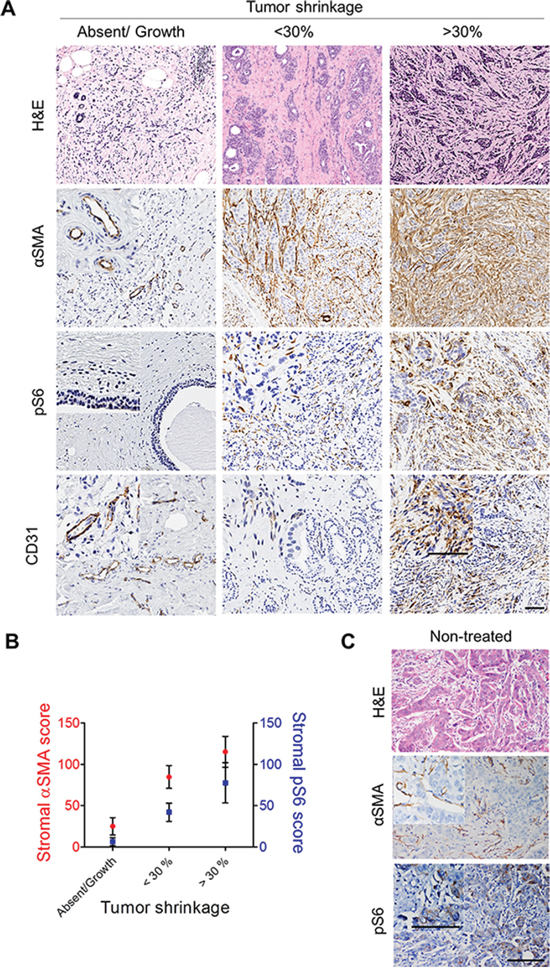 &#x03B1;SMA correlates with tumor reduction and stromal pS6 after neoadjuvant endocrine therapy.