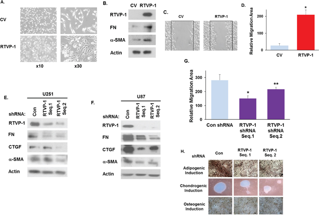 RTVP-1 induces and is required for maintaining the mesenchymal phenotype of glioma cells.
