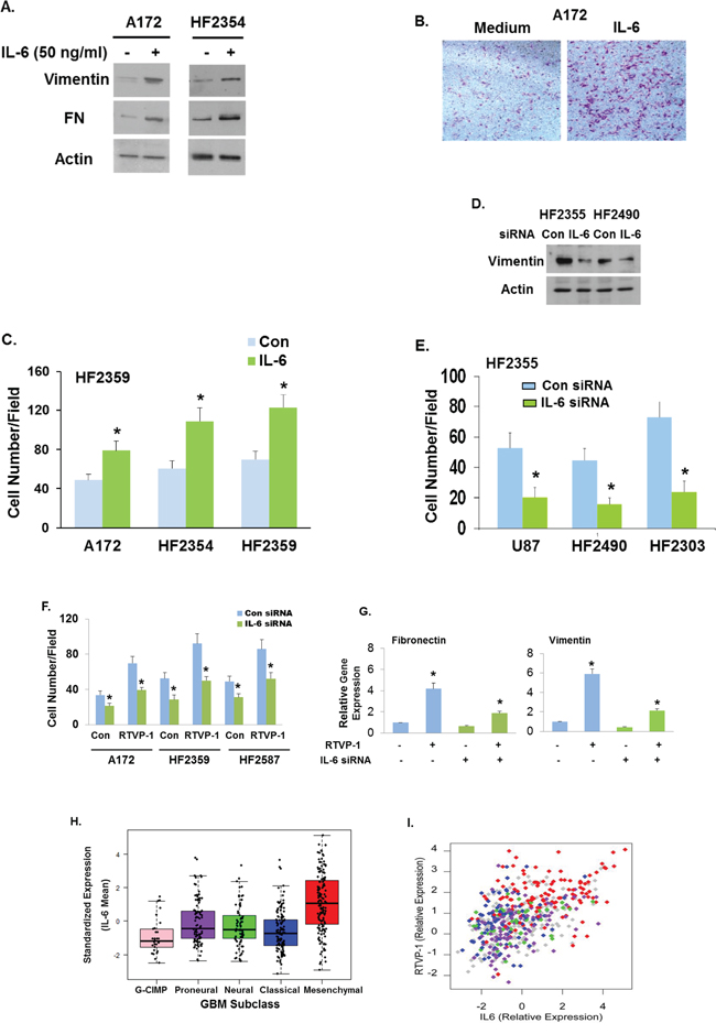RTVP-1 mediates the mesenchymal transformation of glioma cells via the IL-6 pathway.