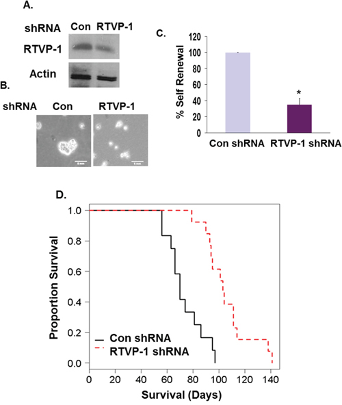 Silencing of RTVP-1 in GSCs prolongs the survival of mice bearing GSC-derived intracranial xenografts.