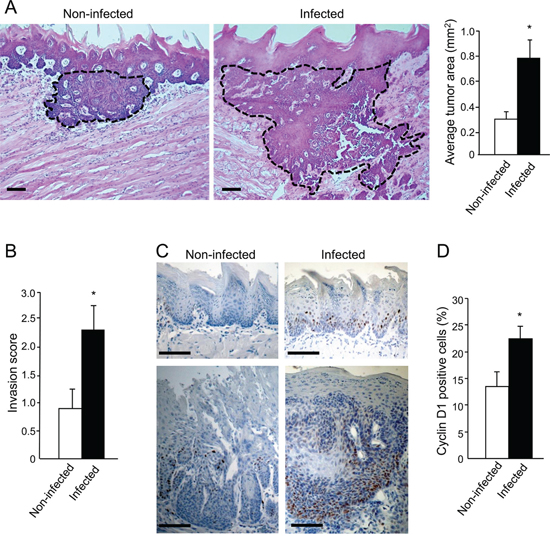 Increased tumor severity in P. gingivalis/F. nucleatum infected mice.