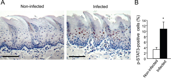 Increased STAT3 activation in tongue epithelium of infected mice.
