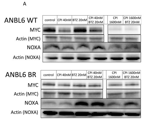 Synergy is independent of change in NOXA and MYC expression.