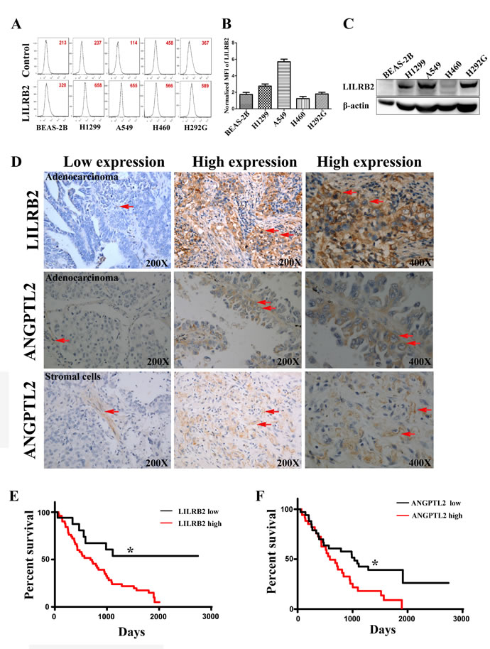 LILRB2 is highly expressed on human cancer cell lines and in primary tumor samples.