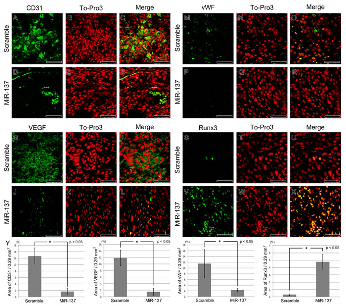 IHC of vasculogenesis and tumour suppressor markers after miR-137 over-expression.