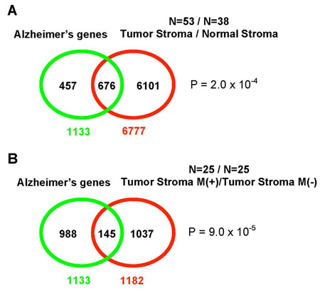 The overlap between the transcriptional profile of AD brains and gene expression in tumor stroma.