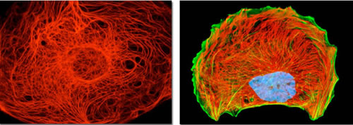 Cytokeratin and vimentin intermediate filament networks in cultured cells.