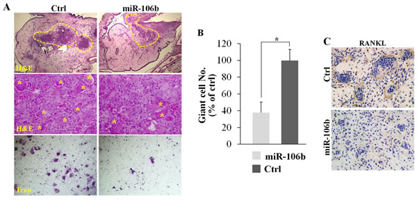 MiR-106b inhibits giant cell formation and the expression of RANKL in GCT