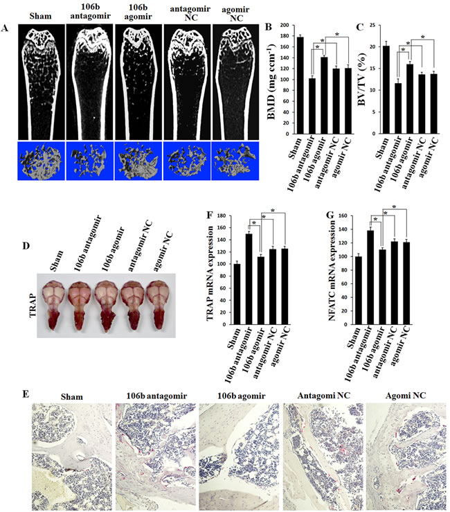 Bone mass is increased and bone resorption is decreased in agomiR-106b treated mice, and the effect of antagomiR-106b is opposite.