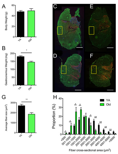 Evidence for atrophy in the white gastrocnemius of aged mice.