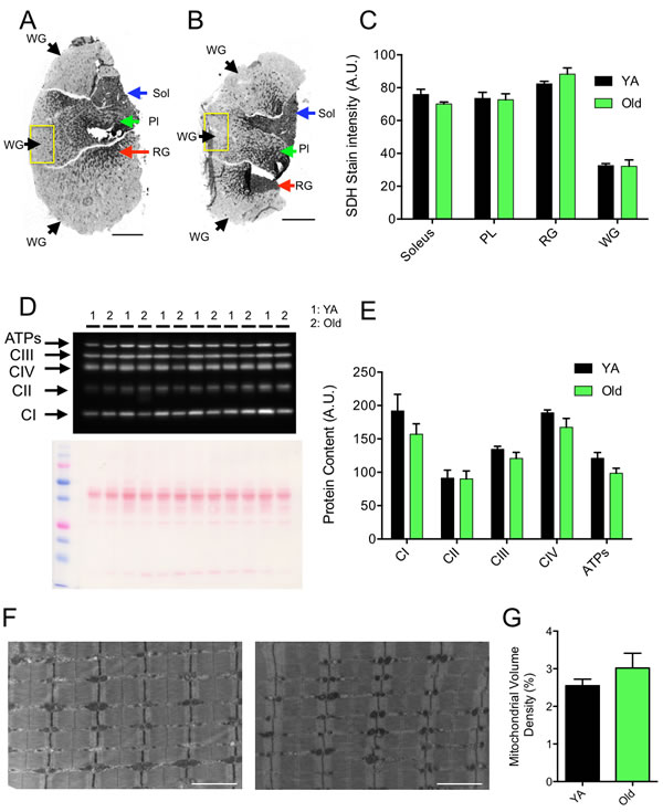 Effects of aging on skeletal muscle mitochondrial content.