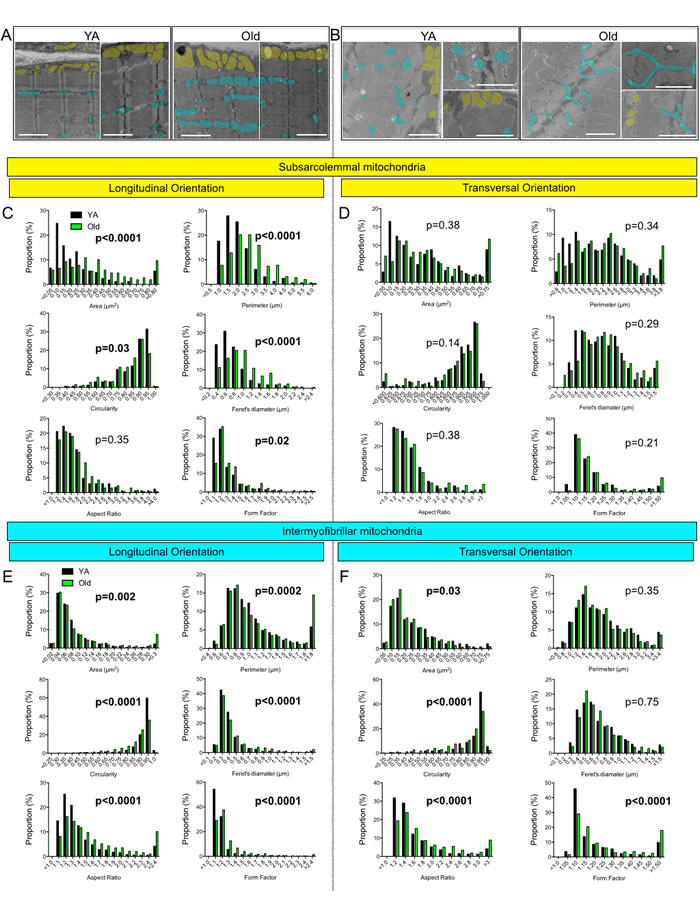 Effects of aging on the morphology of skeletal muscle subsarcolemmal (SS) and intermyofibrillar (IMF) mitochondria.