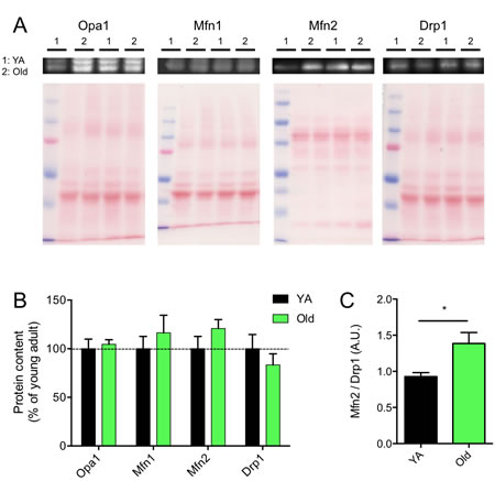 Effects of skeletal muscle aging on the content of proteins regulating mitochondrial dynamics.