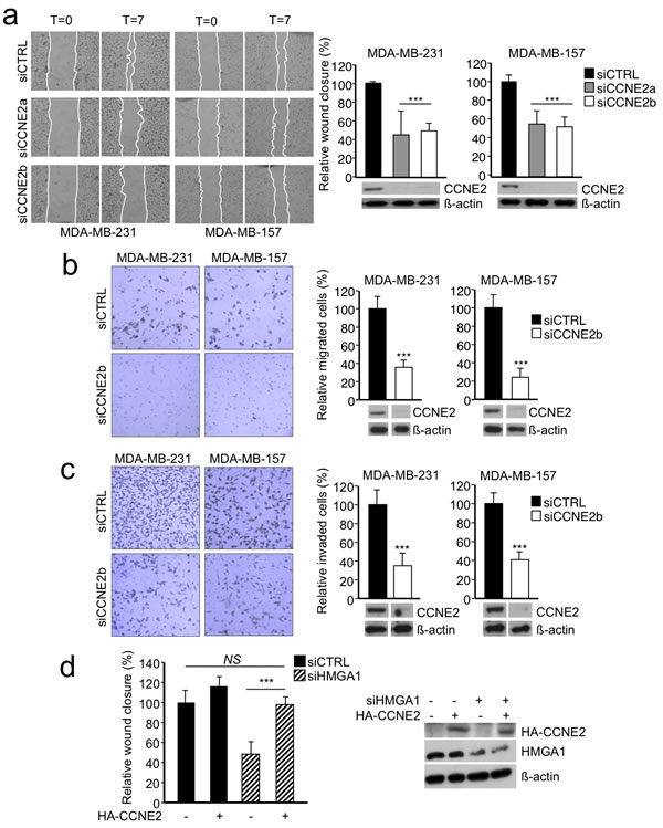 CCNE2 silencing impaired the migration and invasion of basal-like breast cancer cells.